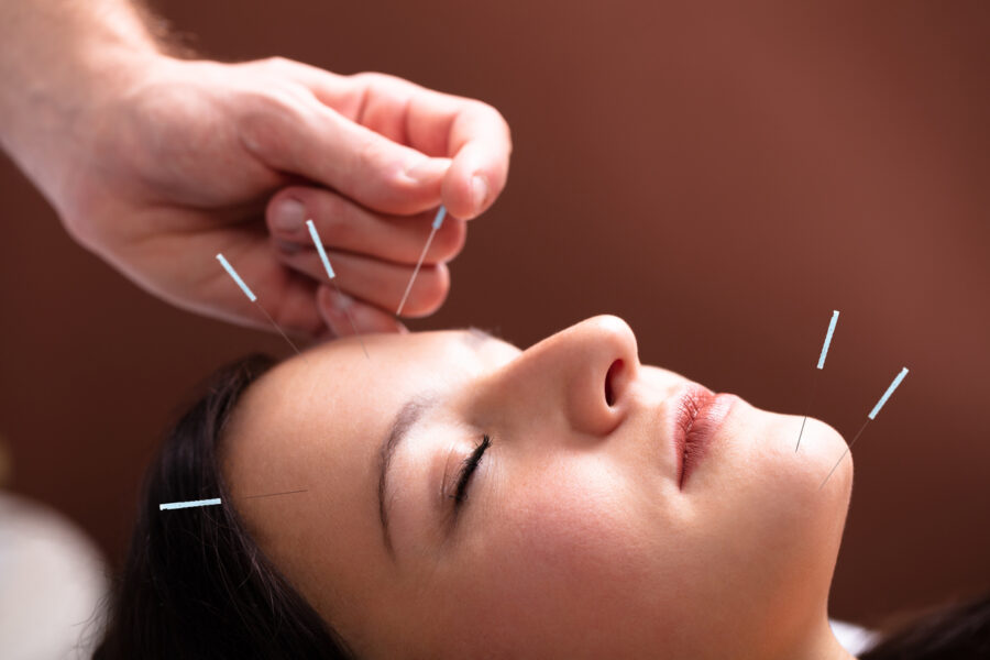 How To Find Reputable Acupuncture Therapy Services